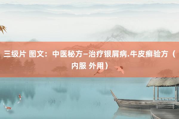 三级片 图文：中医秘方—治疗银屑病.牛皮癣验方（内服 外用）
